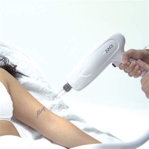 Laser Tattoo Removal