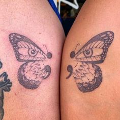  Tattoo Removal Near Me